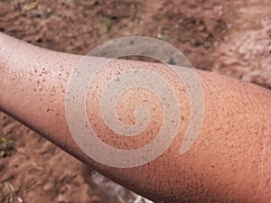 Selective Focus of Dirt on the Skin or Arm with Blurred Background