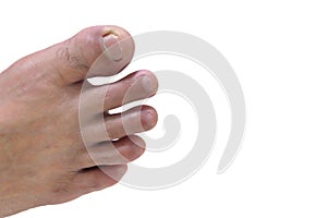 In selective focus a male toe on white isolated background