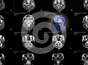 Selective focus of MRI brain sagittal view .