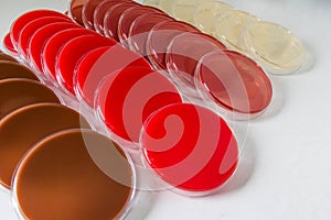 Selective Media for Bacteria growth.