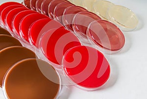 Selective Media for Bacteria growth.