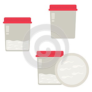 Semen examination, collection containers and sperm counts, seminal fluid in a container for examination or donation photo