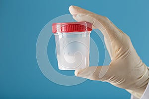 Semen in a jar for analysis in the doctor`s hand on a blue background