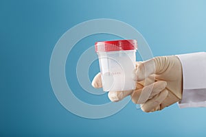 Semen in a jar for analysis in the doctor`s hand on a blue background