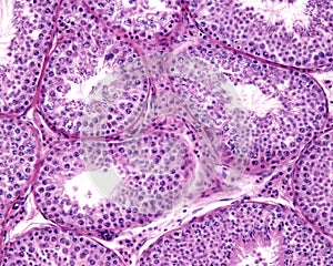 Seminiferous tubules photo