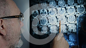 Senior doctor reviewing brain MRI