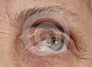 Senior Eye and Wrinkles photo