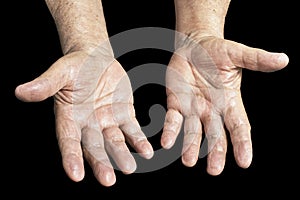 Senior hands