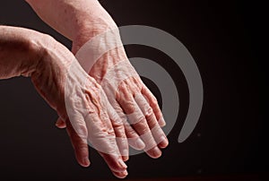 Senior hands. Suffering from pain and rheumatism photo
