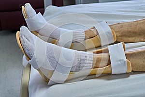 Senior male patient with foot drop and splint. Medical themes