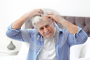 Senior man with hair loss problem