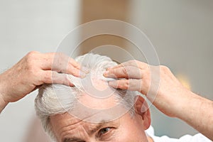 Senior man with hair loss problem indoors