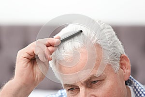 Senior man with hair loss problem indoors