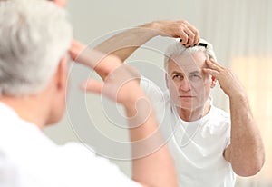 Senior man with hair loss problem looking in mirror