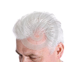 Senior man with hair loss problem on white, closeup