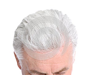 Senior man with hair loss problem on white, closeup