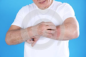 Senior man scratching forearm on color background. Allergy symptom