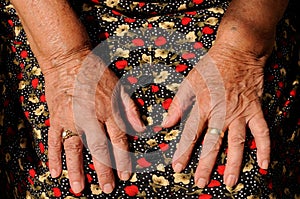 Senior's hands