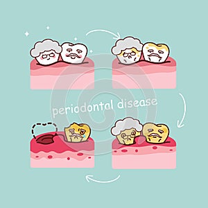 Senior tooth with periodontal disease