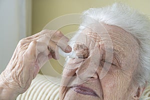 A senior woman applying eyedrops into her eyes by herself