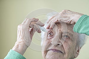 A senior woman applying eyedrops into her eyes by herself