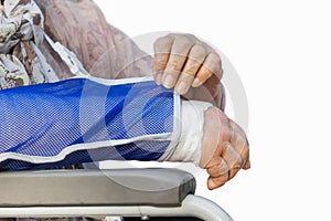 Senior woman with a broken arm on a plaster cast