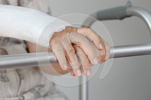 Senior woman with broken arm using walker.