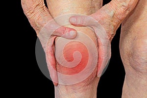 Senior woman holding the knee with pain