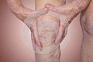 Senior woman holding the knee with pain