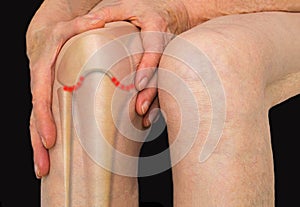 Senior woman holding the knee with pain