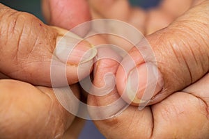 Senior woman nibbling her nails, Close up & Macro shot, Selective focus, Asian body skin part, Healthcare concept