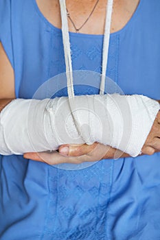 Senior woman with a rewound arm in a cast and bandage. Blow, fracture, bones, hospital