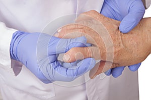 Senior woman with Rheumatoid arthritis visit a doctor