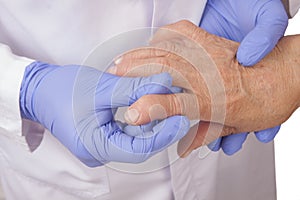 Senior woman with Rheumatoid arthritis visit a doctor photo