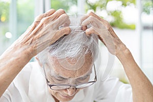 Senior woman scratching her head,itchy scalp and hair loss,allergic reaction to hair care product,allergies to shampoo or photo