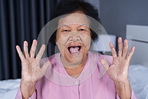 Senior woman with surprised expression