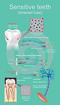 Sensitive dental. photo