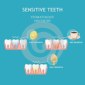 Sensitive teeth. Stomatology dentistry vector concept