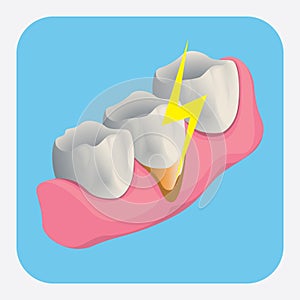 sensitive tooth. Vector illustration decorative design