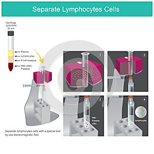Separate Lymphocytes Cells.