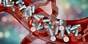 Sepsis, bacteria in blood photo