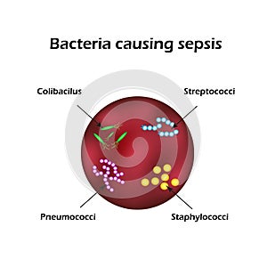 Sepsis. Blood poisoning. E. coli. Streptococci. Pneumococci. Staphylococci. photo