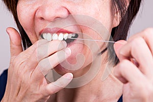 Series of Asian woman flossing teeth with oral floss
