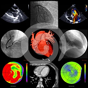 A series of cardiac imaging with different techniques