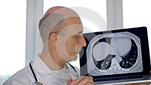 Serious doctor showing laptop computer with CT scan of lungs