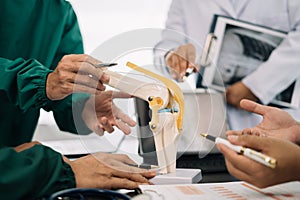 serious doctors team are analyzing fracture knee model showing the process of osteoarthritis patients and knee arthroplasty