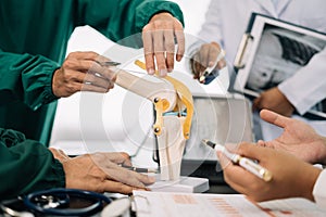 serious doctors team are analyzing fracture knee model showing the process of osteoarthritis patients and knee arthroplasty