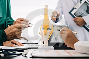 serious doctors team are analyzing fracture knee model showing the process of osteoarthritis patients and knee arthroplasty