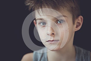 Serious Face with Scars of Young Boy Against Black