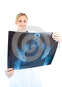 Serious female doctor looking at a x-ray